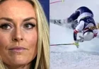 Lindsey Vonn Reveals Shocking X-Ray Images