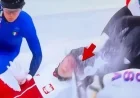 Olympic Skater Suffers Gruesome Facial Injury in Winter Games Race