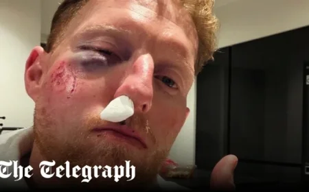 Ben Stokes Injured After Ball Strikes His Face