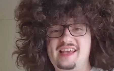 Manchester United Stars Aim for Victory to End Fan’s 500-Day Hair Saga