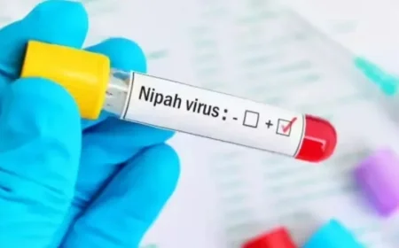 Bengal Reports First Nipah Virus Death, No New Cases Detected