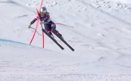 Understanding Complex Tibia Fractures: Lindsey Vonn’s Injury Explained