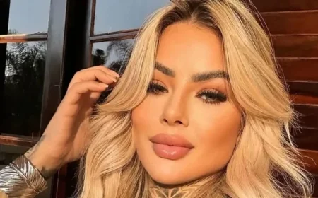 Influencer Bianca Dias Dies Days Post-Cosmetic Procedure