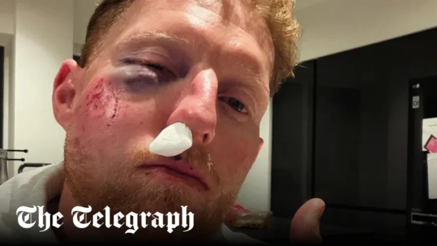Ben Stokes Injured After Ball Strikes His Face