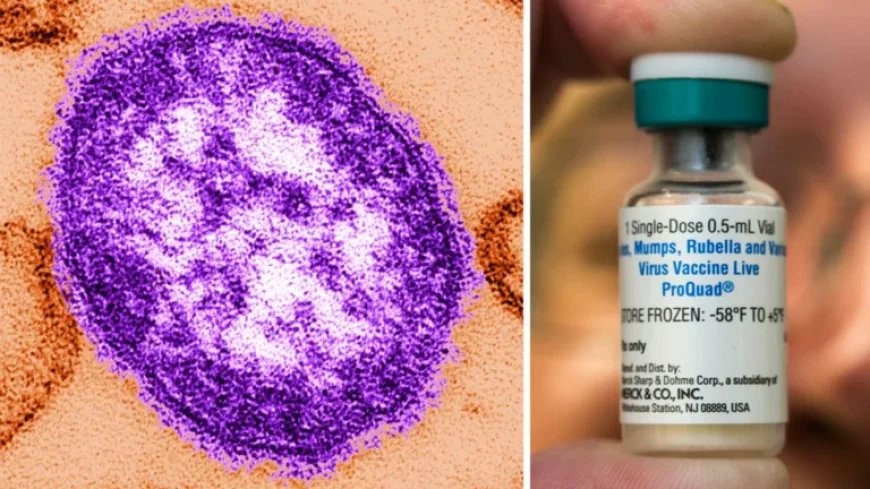 Measles Exposure Alert: Several Wake County Sites Affected
