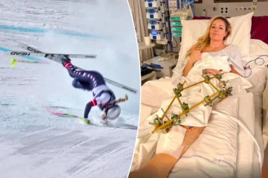 Lindsey Vonn Returns to US for Additional Surgeries
