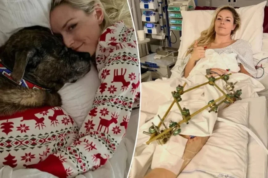 Lindsey Vonn Mourns Beloved Dog’s Death Following Olympics Crash