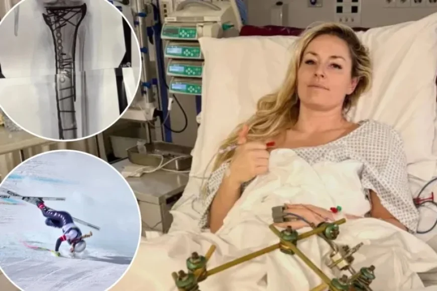 Lindsey Vonn Shares Gruesome Update Post-Olympic Crash: “Truly Bionic Now”