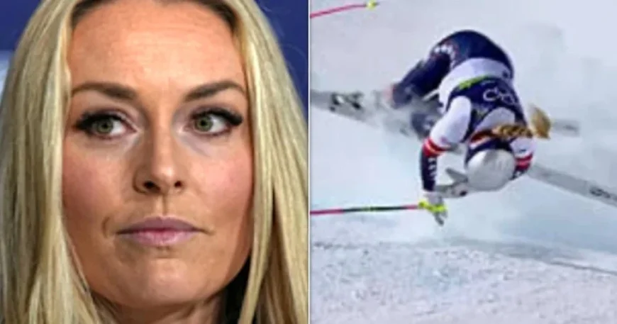 Lindsey Vonn Reveals Shocking X-Ray Images