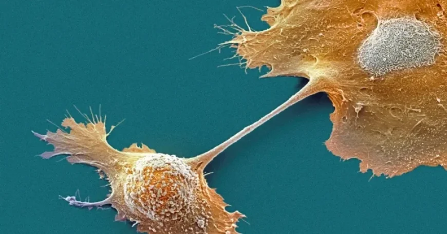 FDA Authorizes Novocure’s New Device to Prolong Pancreatic Cancer Survival