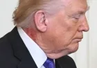 Trump’s Neck Rash Due to Preventative Skin Treatment, Doctor Reveals