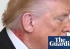 White House: Trump’s Neck Rash Results from Preventative Skin Treatment