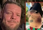 Corey Harrison Asks Fans for Help After Near-Fatal Mexico Crash: Five Revelations
