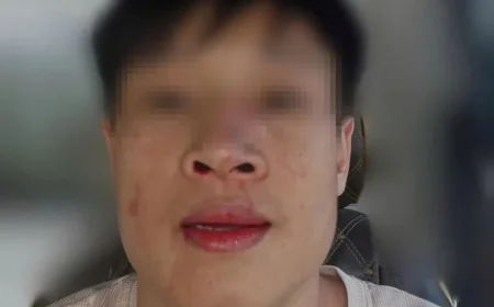 Investigation Launched into Assault on Man in Luong Quy