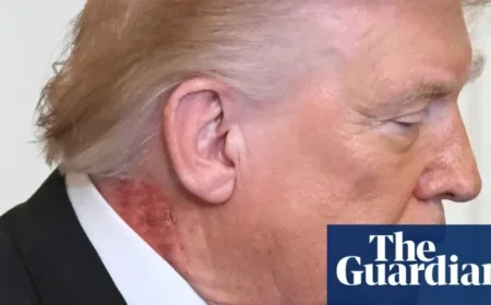 White House: Trump’s Neck Rash Results from Preventative Skin Treatment