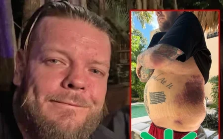 Corey Harrison and the hospital bills that followed a motorcycle crash: asking fans for help