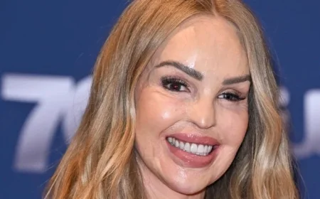 Katie Piper: Attacker Set for Parole After 16 Years