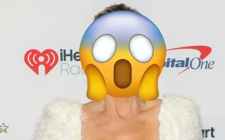 Alexis Bellino draws fan concern after sharing black-eye photo as RHOC filming reunion images circulate