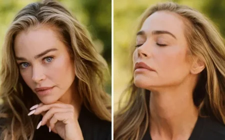 Denise Richards: Shocking Facelift Photos and the 5 Surprising Details She Revealed