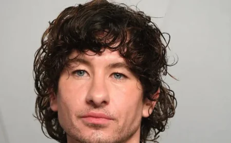 Barry Keoghan Faces Frequent Criticism Over His Appearance