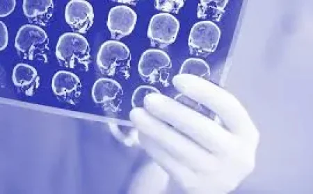 4dx Asx: ASX 300 stock rockets 38% as Mayo Clinic deploys CT:VQ