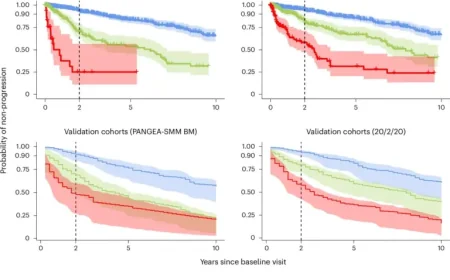 Myeloma Cancer: New Dynamic Risk Tool and CAR T Shift Force Earlier Action