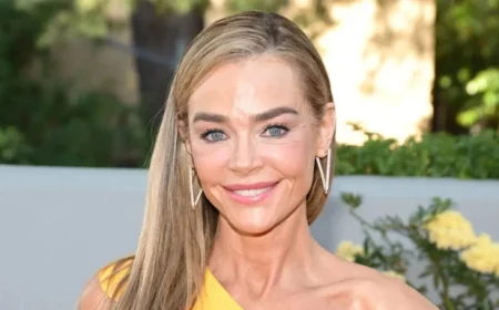 Denise Richards Proves Facelifts Are No Longer Embarrassing