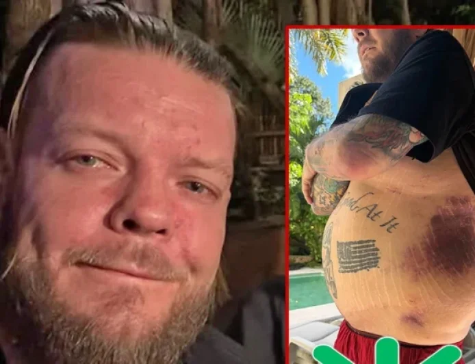 Corey Harrison and the hospital bills that followed a motorcycle crash: asking fans for help