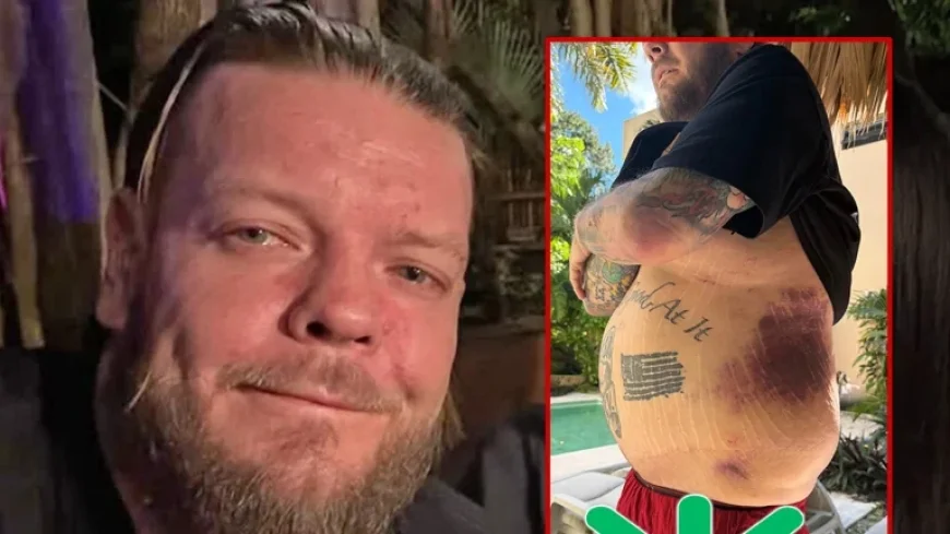 Corey Harrison and the hospital bills that followed a motorcycle crash: asking fans for help