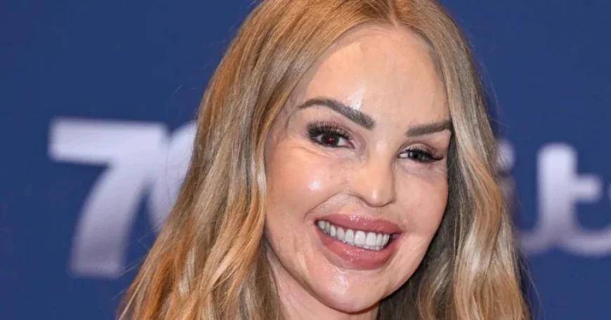 Katie Piper: Attacker Set for Parole After 16 Years