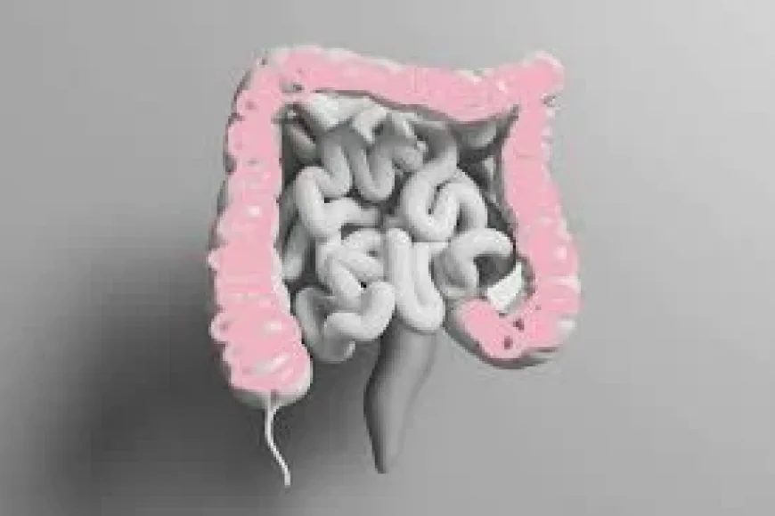 Colon Cancer Symptoms: Now Leading Cause of Cancer Deaths Under 50 in US