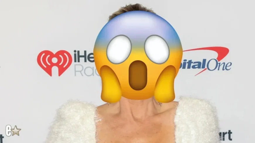 Alexis Bellino draws fan concern after sharing black-eye photo as RHOC filming reunion images circulate