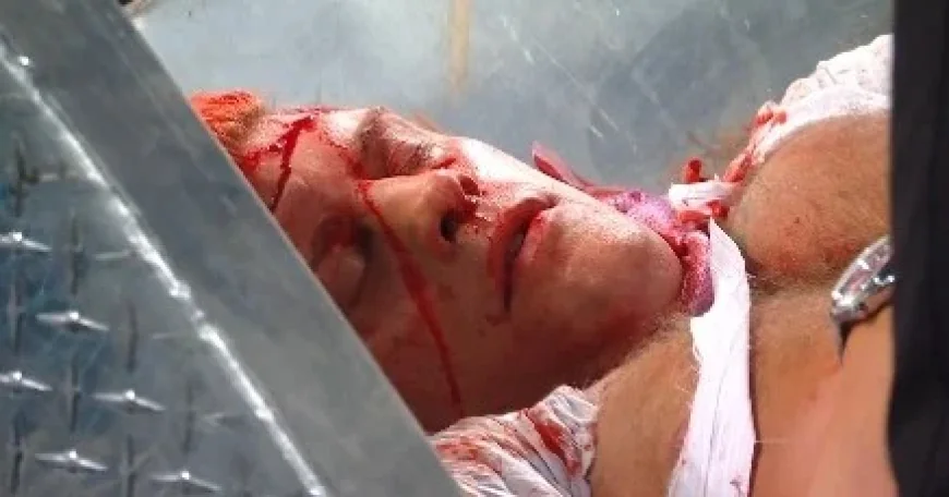 Orton Betrays Rhodes, Draws Blood at WrestleMania Contract Signing