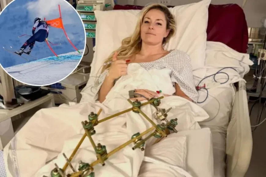 Lindsey Vonn Dismisses Retirement Rumors After Father’s Injury Appeal