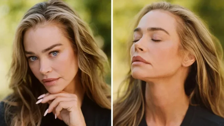 Denise Richards: Shocking Facelift Photos and the 5 Surprising Details She Revealed