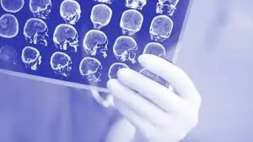 4dx Asx: ASX 300 stock rockets 38% as Mayo Clinic deploys CT:VQ