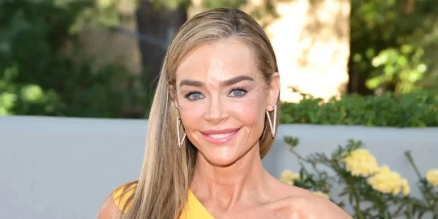 Denise Richards Proves Facelifts Are No Longer Embarrassing