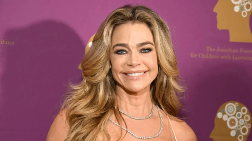 Denise Richards’ Facelift Transformation Stuns in Before and After Photos