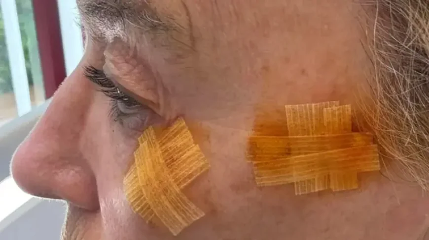 Liz Mccolgan Issues Health Warning After Lesions Removed — 5 Lessons for Athletes