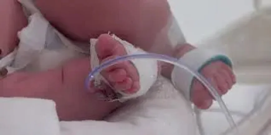 Plastic chemicals linked to millions of Preterm Birth cases and infant deaths