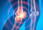 Animal Study: Experimental Drug Reverses Osteoarthritis in Weeks