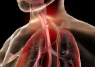 Oesophageal Cancer and the Hidden Question Behind Barrett’s Esophagus