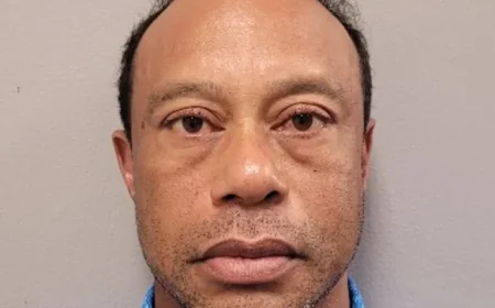 Tiger Woods Withdraws from Masters to Seek Treatment After Car Crash