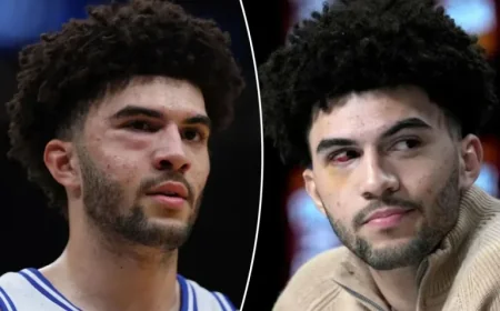 Cameron Boozer Endures Facial Fractures in Defeat to UConn