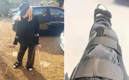 Michelle Collins defends hospital after fall: 3 details behind her Norfolk A&E visit