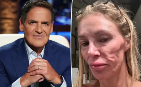 Mark Cuban Pharmacy Helped Brandi Glanville Cut Medication Costs Amid Facial Disfigurement Fight