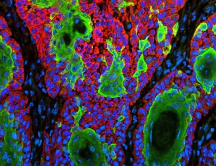 FDA Rejects Replimune’s Skin Cancer Drug Again in Flashpoint Decision