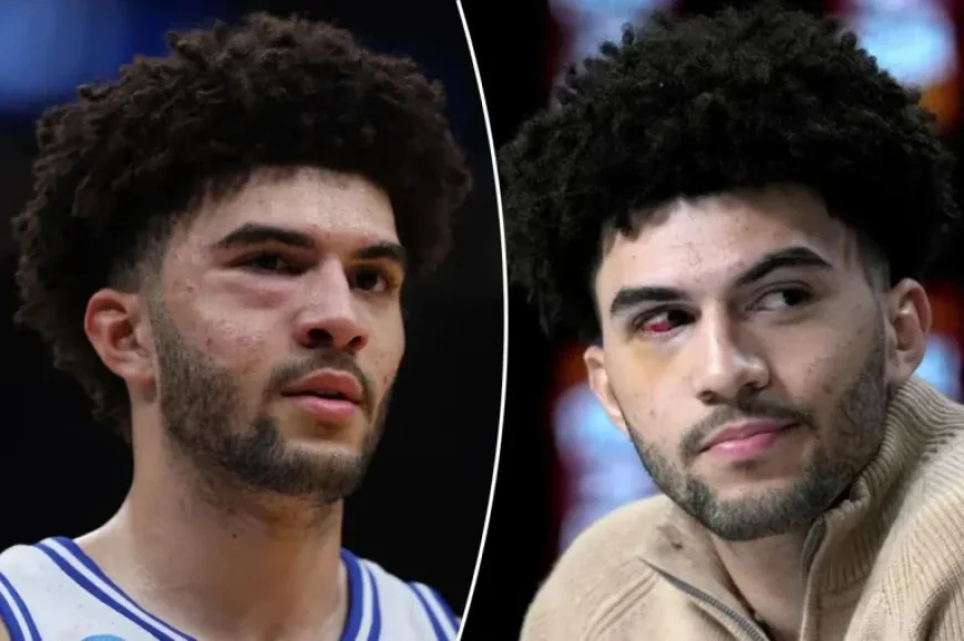 Cameron Boozer Endures Facial Fractures in Defeat to UConn