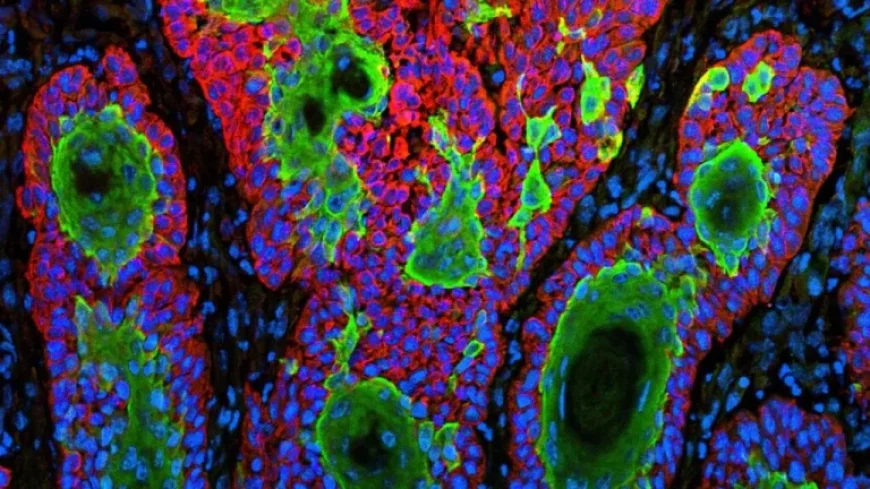 FDA Rejects Replimune’s Skin Cancer Drug Again in Flashpoint Decision