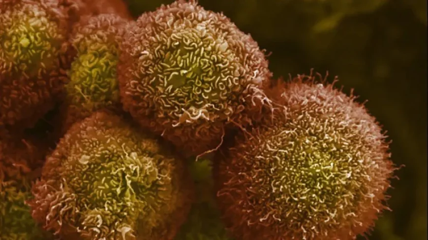 Revolution Medicines Announces Breakthrough in Pancreatic Cancer Treatment